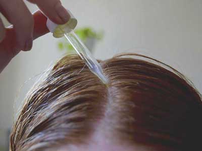 cedarwood oil for hair loss